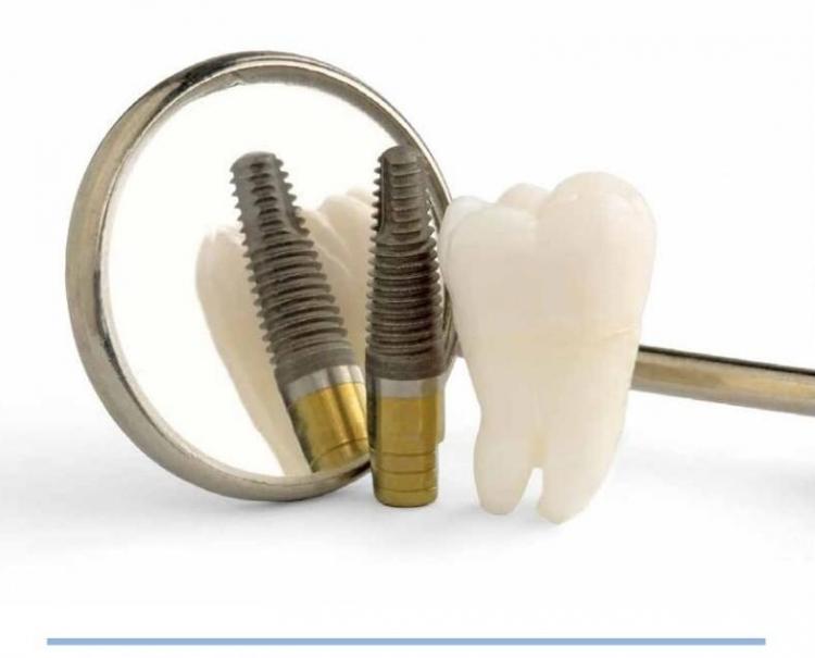 Impianto dentale e chirurgia orale — 2